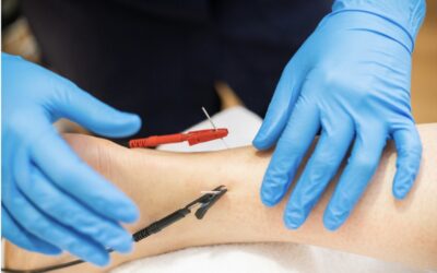 Miksi käytän sähköakupunktiota kivunhoidossa vastaanotollani? – Nykyaikaista ja tieteellistä lähestymistapaa